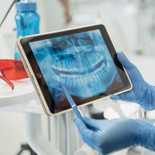 Dental Implant Solutions – Kona Big Island Hawaii